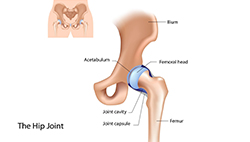 Image of Hip Joint