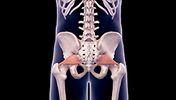 Piriformis Syndrome