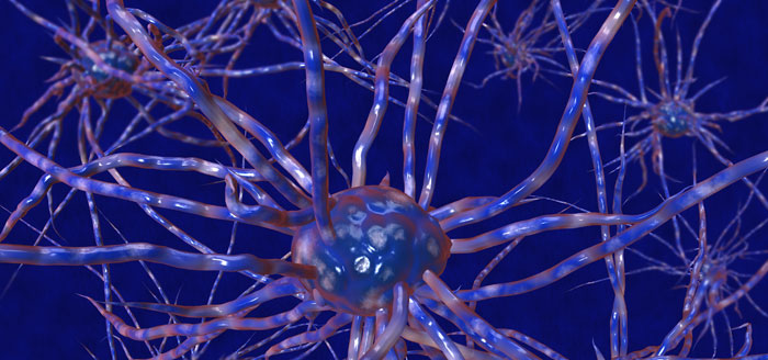 Electrodiagnostic Testing (EMG)