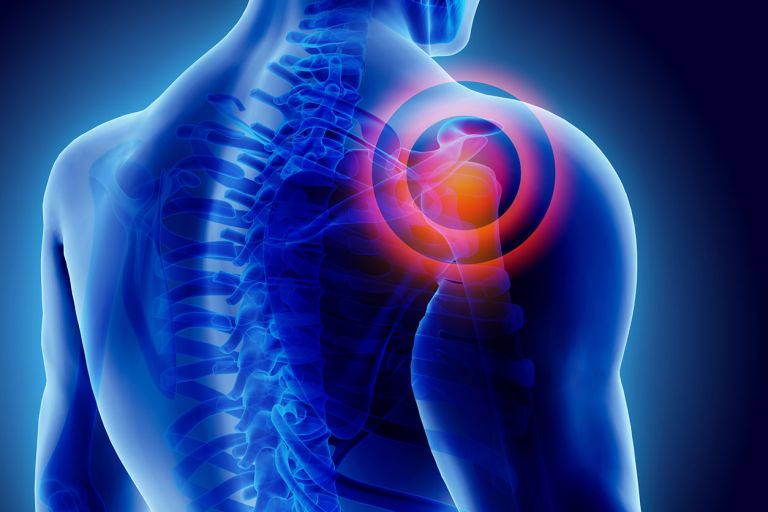 Common Shoulder Conditions And Treatments