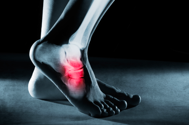 Common Basketball Foot and Ankle Injuries