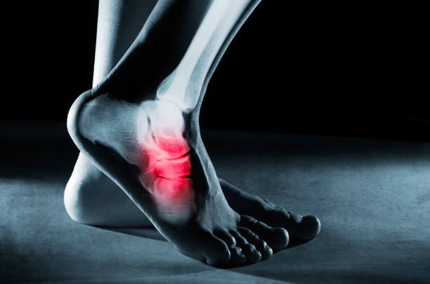 Common Basketball Foot And Ankle Injuries