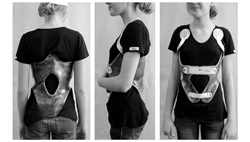 All About Kyphosis Palos Hills and Mokena