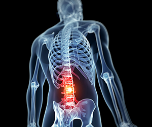 Treat Herniated Discs at MidAmerica's Palos Hills, Mokena and Chicago  Locations