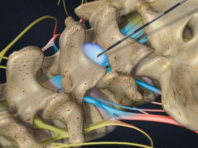 Pain Management Clinic